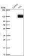 AXL Receptor Tyrosine Kinase antibody, NBP1-83073, Novus Biologicals, Western Blot image 