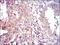 Forkhead Box O1 antibody, GTX60558, GeneTex, Immunohistochemistry paraffin image 