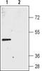 Bestrophin 2 antibody, TA328717, Origene, Western Blot image 