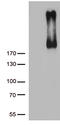 Erb-B2 Receptor Tyrosine Kinase 3 antibody, LS-C793860, Lifespan Biosciences, Western Blot image 