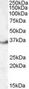 LIM and SH3 domain protein 1 antibody, PA5-18828, Invitrogen Antibodies, Western Blot image 