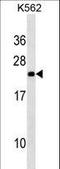 NOP16 Nucleolar Protein antibody, LS-C158407, Lifespan Biosciences, Western Blot image 