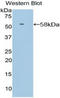 Selectin L antibody, LS-C296360, Lifespan Biosciences, Western Blot image 