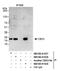 Chromobox 3 antibody, NB100-41429, Novus Biologicals, Western Blot image 