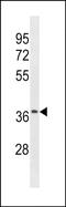 Olfactory Receptor Family 52 Subfamily J Member 3 antibody, PA5-49226, Invitrogen Antibodies, Western Blot image 