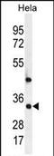 Mediator Complex Subunit 7 antibody, PA5-71606, Invitrogen Antibodies, Western Blot image 