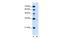 Phospholipid Phosphatase 1 antibody, GTX47072, GeneTex, Western Blot image 