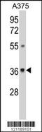 UDP-Galactose-4-Epimerase antibody, 62-529, ProSci, Western Blot image 