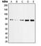 Protein Kinase C Zeta antibody, GTX32247, GeneTex, Western Blot image 