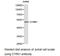 CYR61 antibody, LS-C192991, Lifespan Biosciences, Western Blot image 