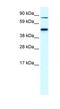 Erythrocyte Membrane Protein Band 4.2 antibody, NBP1-56647, Novus Biologicals, Western Blot image 