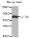 Carnitine Palmitoyltransferase 1B antibody, abx005212, Abbexa, Western Blot image 
