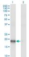 Actin Related Protein 2/3 Complex Subunit 3 antibody, H00010094-M06, Novus Biologicals, Western Blot image 