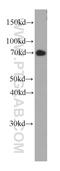 Fucosyltransferase 8 antibody, 66118-1-Ig, Proteintech Group, Western Blot image 
