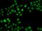 Sulfotransferase Family 2B Member 1 antibody, orb373726, Biorbyt, Immunocytochemistry image 