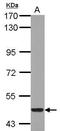 Cytochrome P450 Family 26 Subfamily A Member 1 antibody, PA5-28165, Invitrogen Antibodies, Western Blot image 