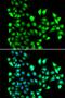 Small Nuclear Ribonucleoprotein D2 Polypeptide antibody, PA5-77087, Invitrogen Antibodies, Immunofluorescence image 