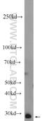Mtlr1 antibody, 24571-1-AP, Proteintech Group, Western Blot image 