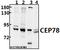 Centrosomal Protein 78 antibody, A13706-1, Boster Biological Technology, Western Blot image 