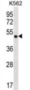 Coiled-Coil Domain Containing 71 antibody, abx026842, Abbexa, Western Blot image 