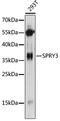Sprouty RTK Signaling Antagonist 3 antibody, LS-C749657, Lifespan Biosciences, Western Blot image 