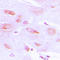 G Protein-Coupled Receptor Kinase 2 antibody, LS-C351799, Lifespan Biosciences, Immunohistochemistry paraffin image 