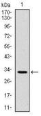 TNF Receptor Superfamily Member 8 antibody, NBP2-22206, Novus Biologicals, Western Blot image 