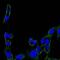 Protein Tyrosine Kinase 2 antibody, MA5-15588, Invitrogen Antibodies, Immunofluorescence image 
