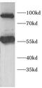 DAB Adaptor Protein 2 antibody, FNab10718, FineTest, Western Blot image 
