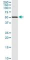 Sphingosine Kinase 2 antibody, H00056848-D01P, Novus Biologicals, Western Blot image 