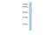 Heterogeneous Nuclear Ribonucleoprotein U antibody, NBP1-57146, Novus Biologicals, Western Blot image 