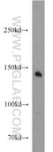 Macrophage Stimulating 1 Receptor antibody, 11053-1-AP, Proteintech Group, Western Blot image 