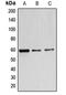 Beta-1,4-N-Acetyl-Galactosaminyltransferase 1 antibody, orb213965, Biorbyt, Western Blot image 