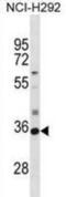 Sulfotransferase Family 2A Member 1 antibody, abx028962, Abbexa, Western Blot image 