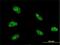Zinc finger homeobox protein 3 antibody, H00000463-M01, Novus Biologicals, Immunocytochemistry image 