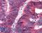 Apelin Receptor antibody, LS-A62, Lifespan Biosciences, Immunohistochemistry paraffin image 