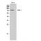 G Protein-Coupled Receptor Kinase 2 antibody, LS-C383855, Lifespan Biosciences, Western Blot image 