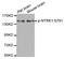 Neurotrophic Receptor Tyrosine Kinase 1 antibody, STJ22321, St John