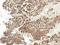 Voltage Dependent Anion Channel 1 antibody, LS-C773585, Lifespan Biosciences, Immunohistochemistry frozen image 