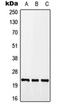 Calcyon Neuron Specific Vesicular Protein antibody, orb215566, Biorbyt, Western Blot image 