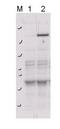 Rho Associated Coiled-Coil Containing Protein Kinase 2 antibody, orb345586, Biorbyt, Western Blot image 