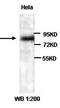 Hyaluronidase 1 antibody, orb77169, Biorbyt, Western Blot image 