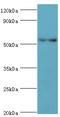 Patatin-like phospholipase domain-containing protein 3 antibody, MBS1499072, MyBioSource, Western Blot image 