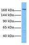 ATP Binding Cassette Subfamily C Member 2 antibody, GTX44679, GeneTex, Western Blot image 