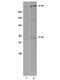 Frizzled Class Receptor 5 antibody, ab14475, Abcam, Western Blot image 