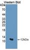 General Transcription Factor IIH Subunit 5 antibody, LS-C663459, Lifespan Biosciences, Western Blot image 