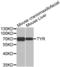 Tyrosinase antibody, abx001163, Abbexa, Western Blot image 