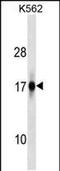 AN1-type zinc finger protein 2A antibody, PA5-48946, Invitrogen Antibodies, Western Blot image 