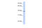 Tetraspanin-10 antibody, ARP50022_P050, Aviva Systems Biology, Western Blot image 