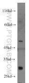 TNF Receptor Associated Factor 1 antibody, 11543-1-AP, Proteintech Group, Western Blot image 